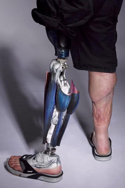 muscle-prosthetic-leg03