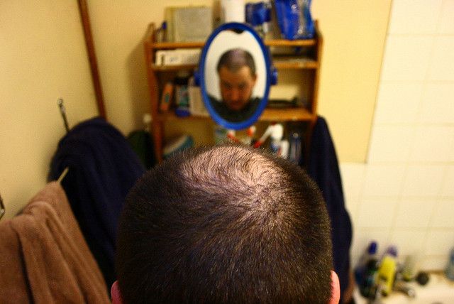 Ways To Delay And Prevent Hair Loss Oh The Joys Of Getting Older