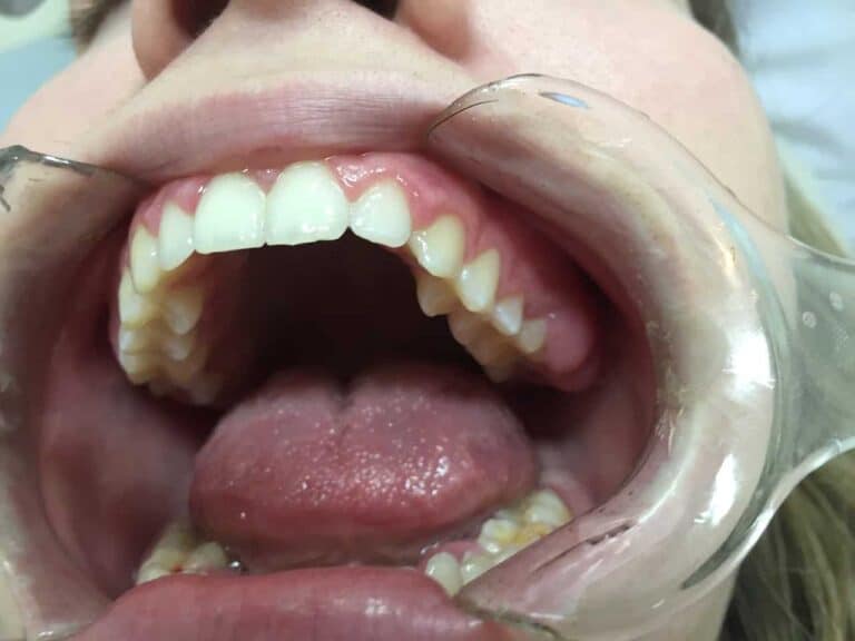 dentist inside mouth