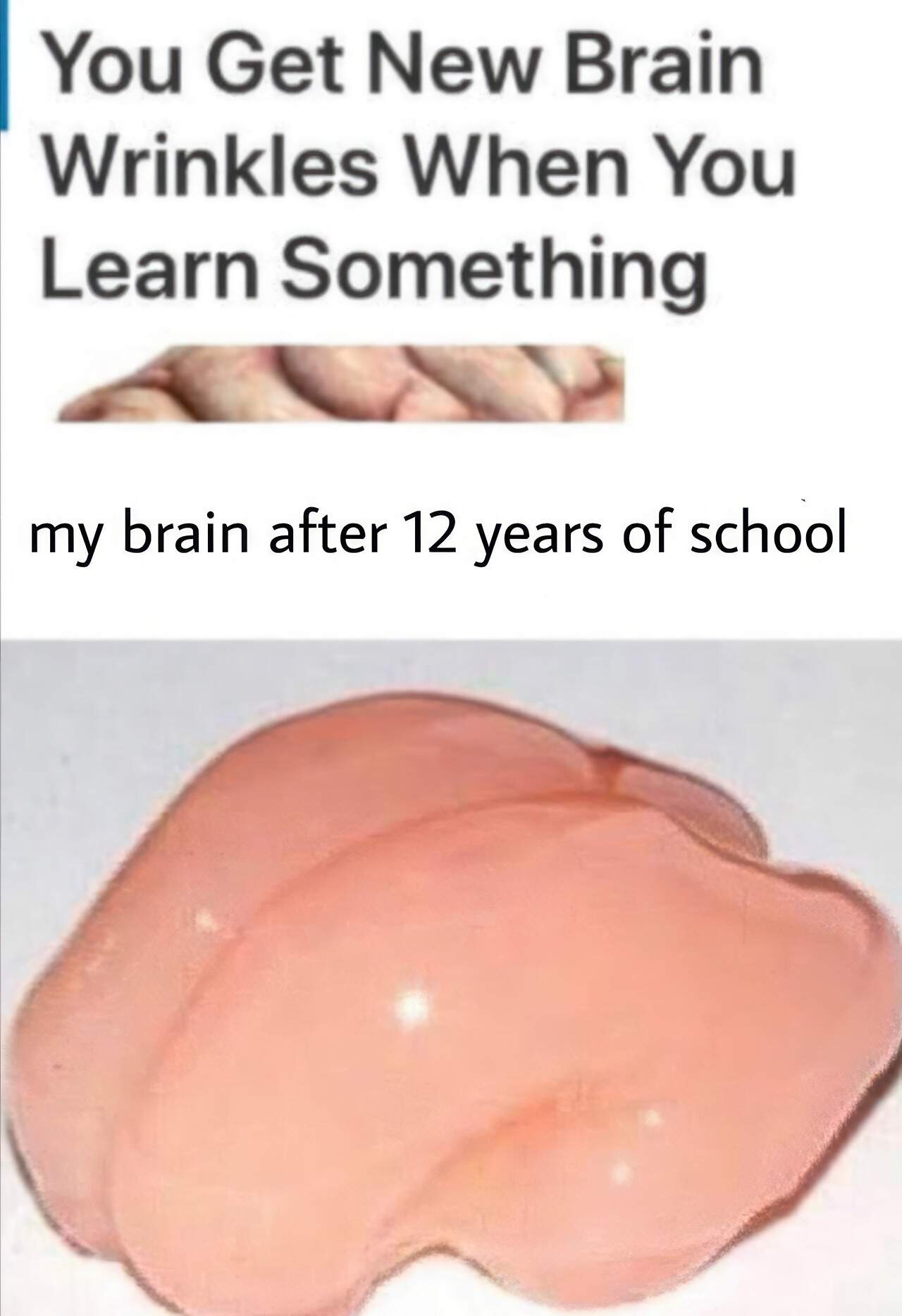 The Best Smooth Brain Jokes to Brighten Your Day 11 smooth brain you get new brain wrinkles meme