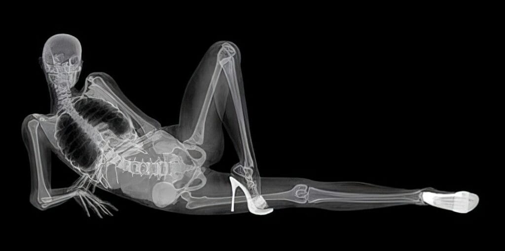 X Ray Pin Up Calendar 1