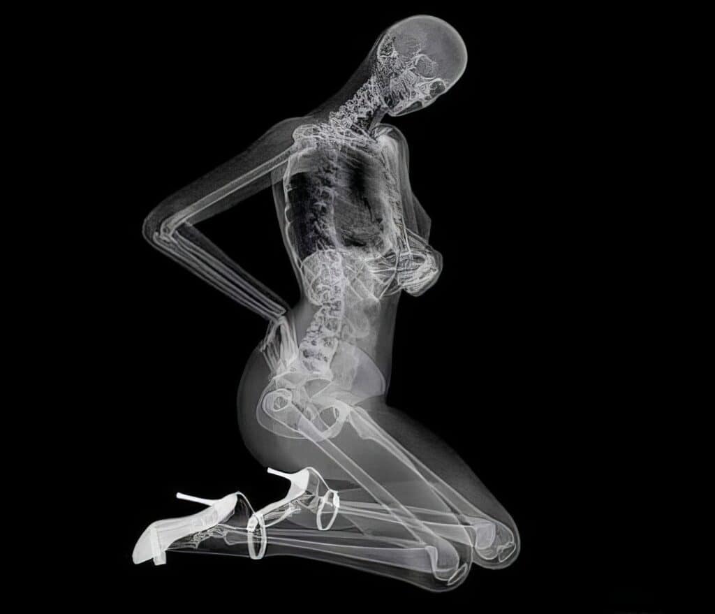 X-ray image of a woman in high heels kneeling with hands on her hips, showcasing internal skeletal structure against a black background, emphasizing medical imaging and anatomy.