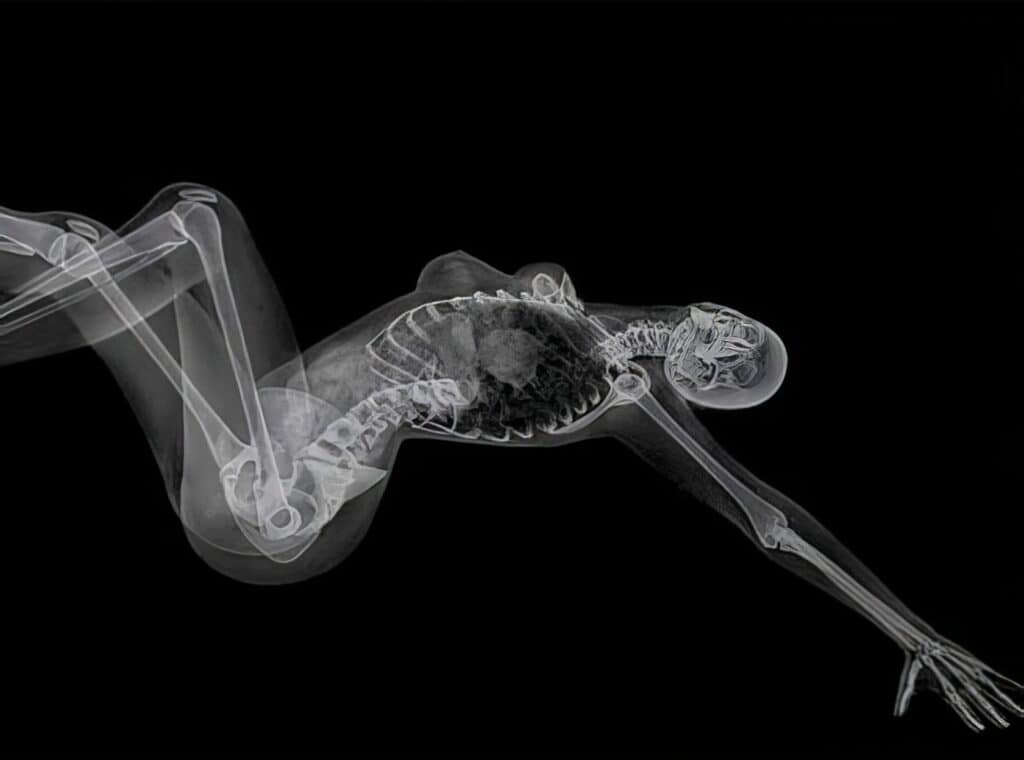 X-ray image of a bird skeleton, showing bones and structure in detail, with a black background for emphasis.
