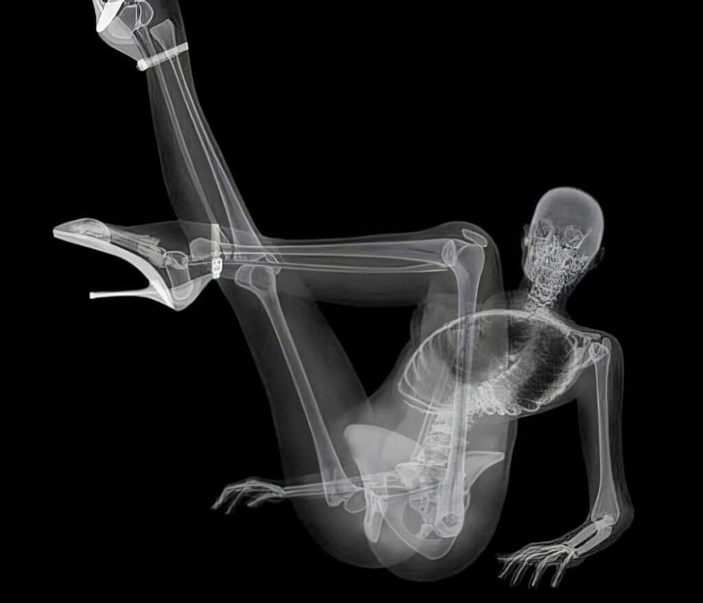 X Ray Pin Up Calendar 2