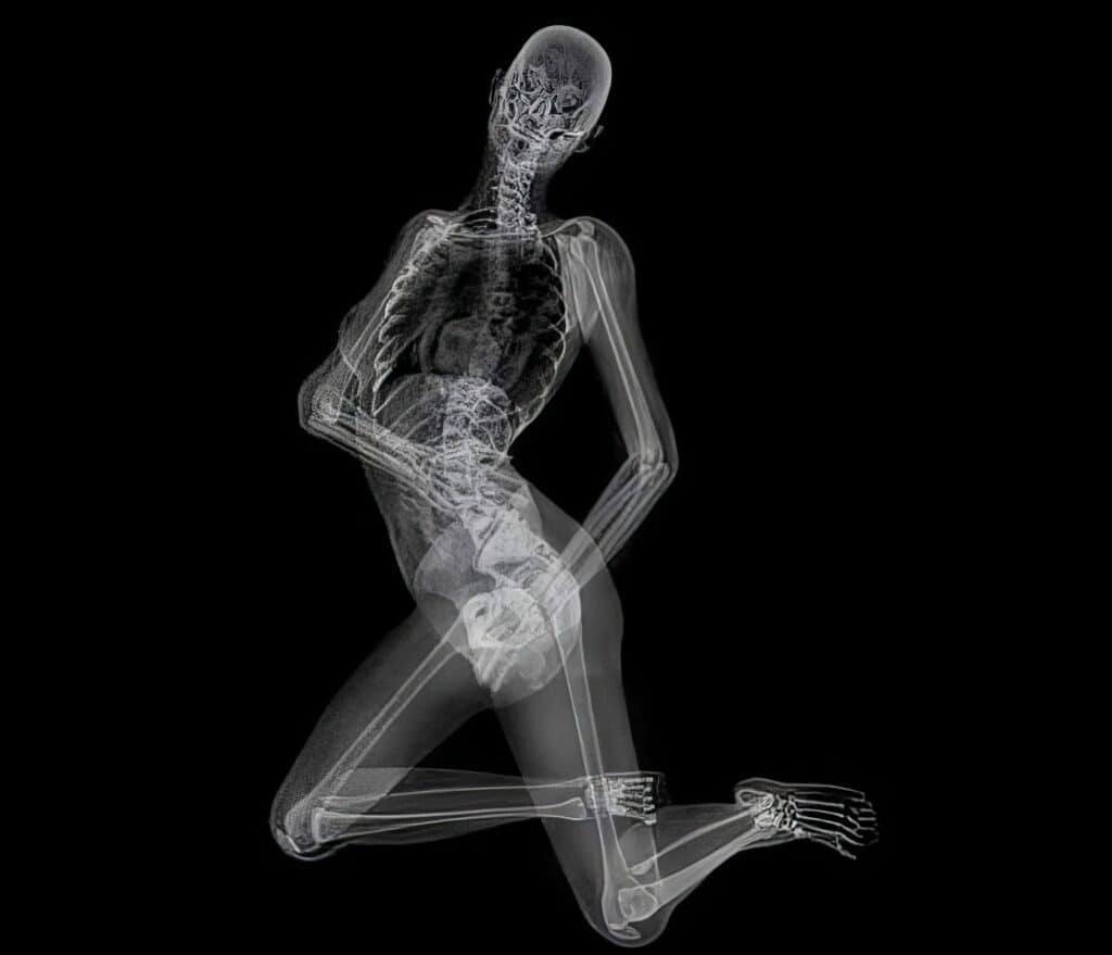 X Ray Pin Up Calendar 3