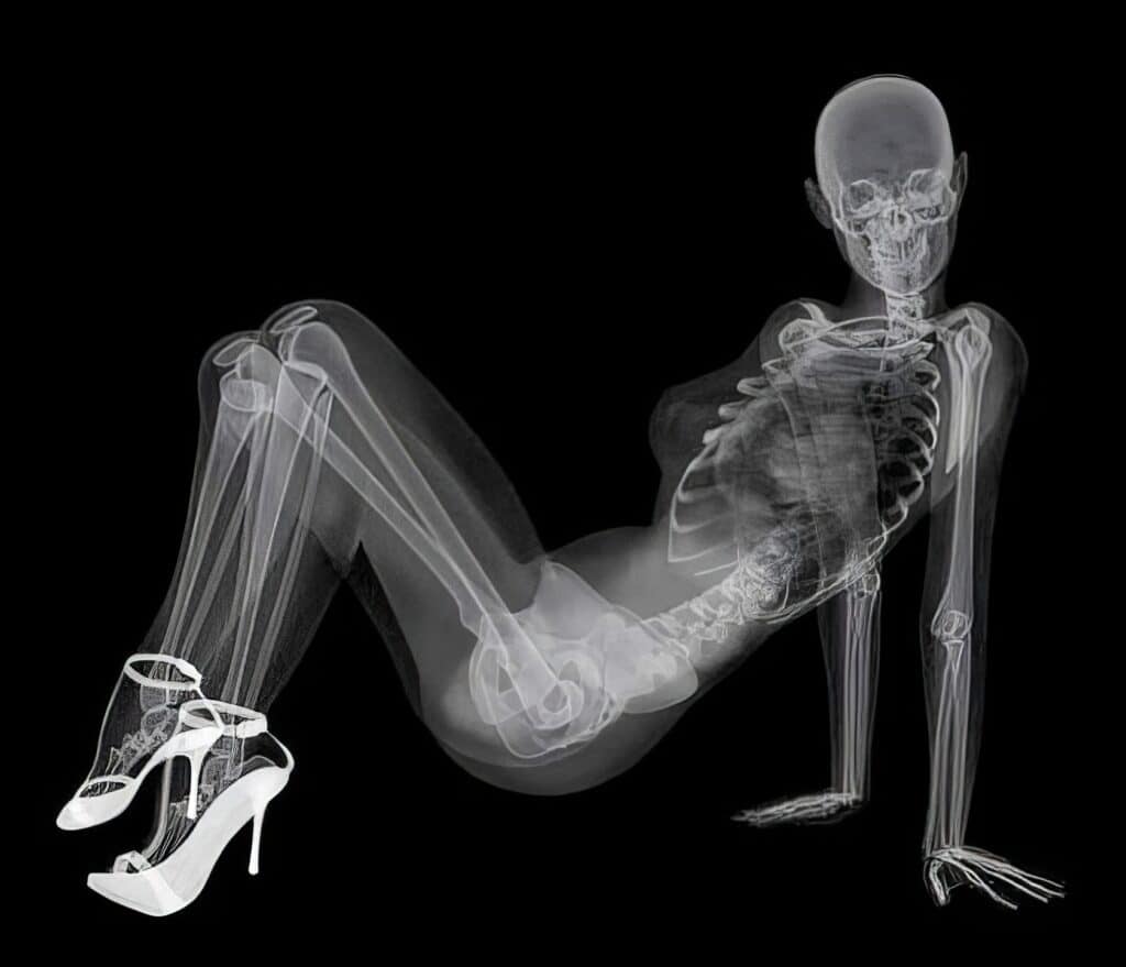 X Ray Pin Up Calendar 4