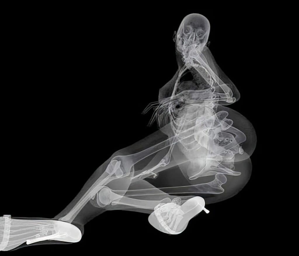 X Ray Pin Up Calendar 5