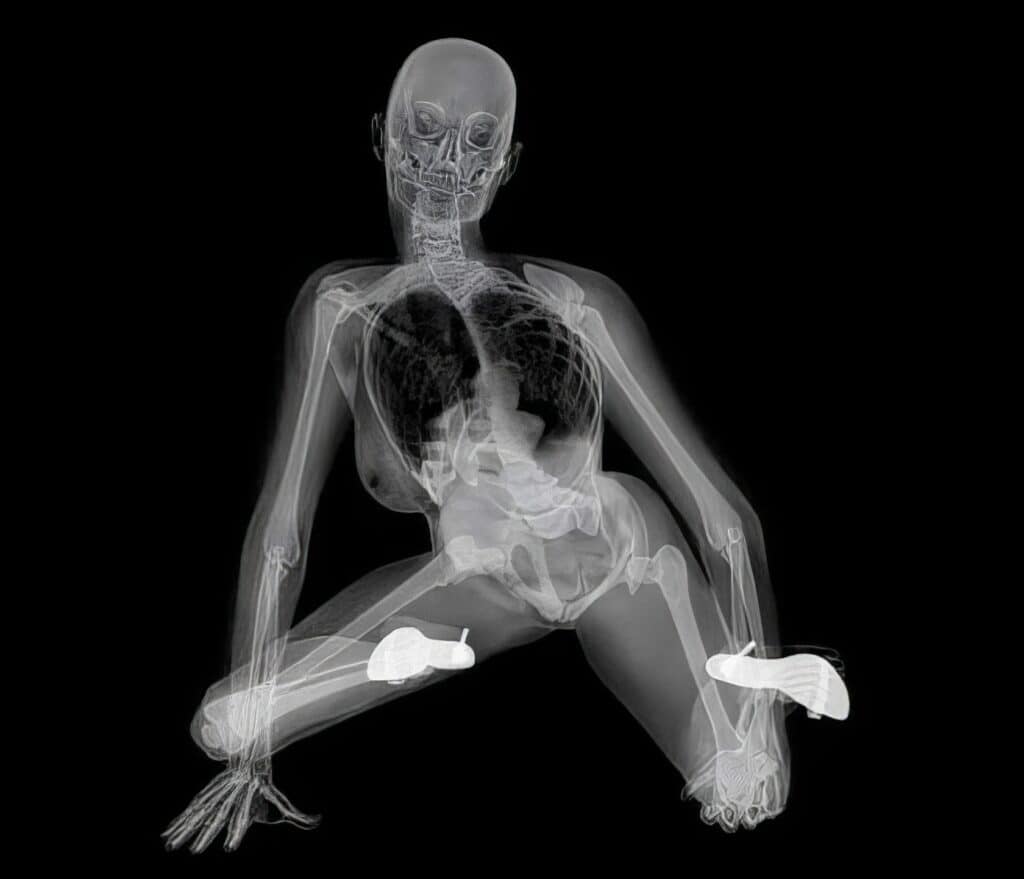 X Ray Pin Up Calendar 6