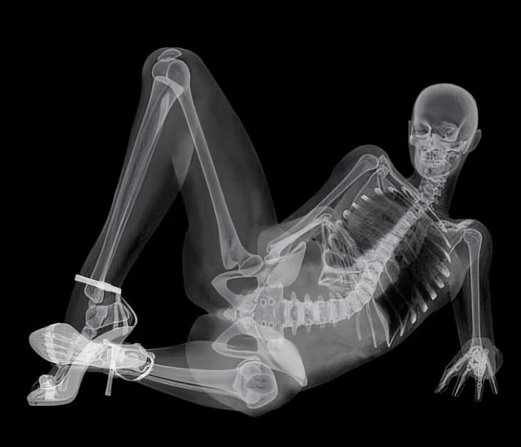X-ray image of a human skeletal structure with a human-like figure wearing glasses, lying on a black background, highlighting bones and joints in a semi-transparent style.