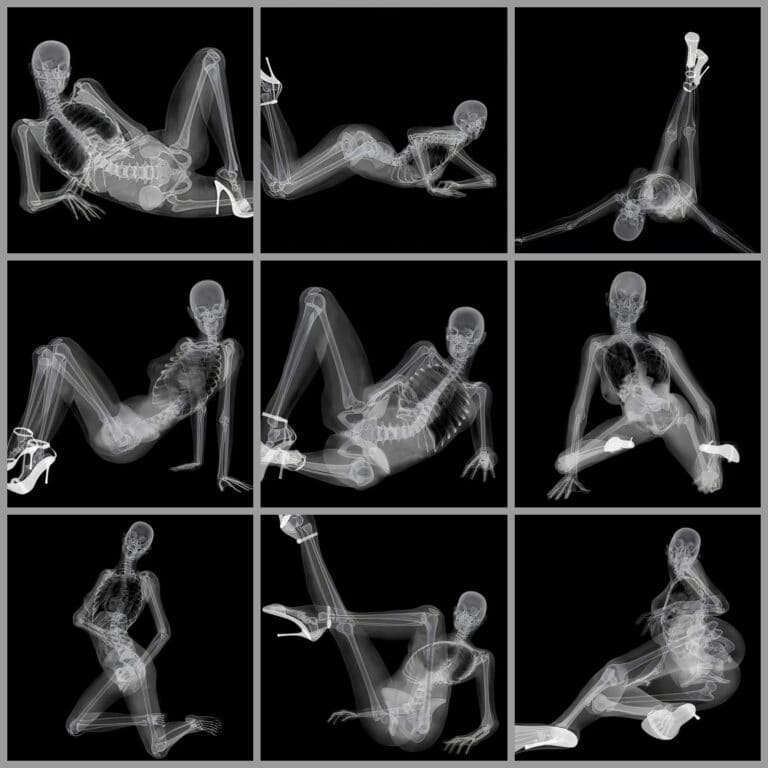 X-ray images of various provocative and suggestive poses by skeletons, emphasizing adult entertainment, erotic art, and experimental photography with creative, eye-catching compositions.