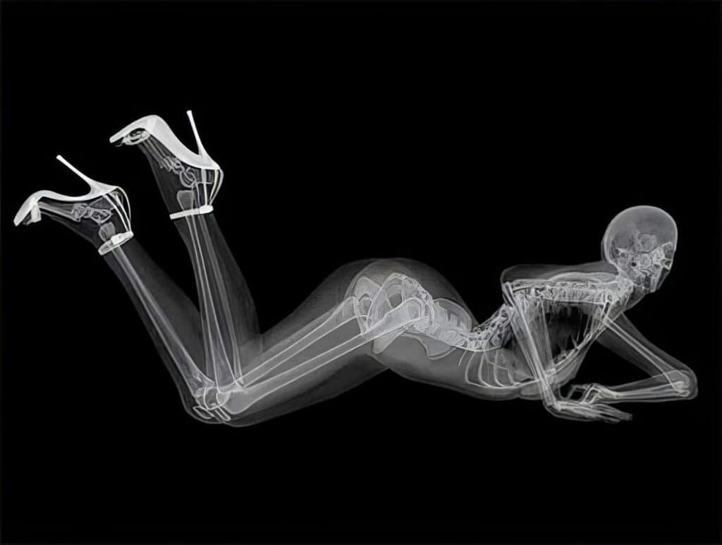 X Ray Pin Up Calendar 9
