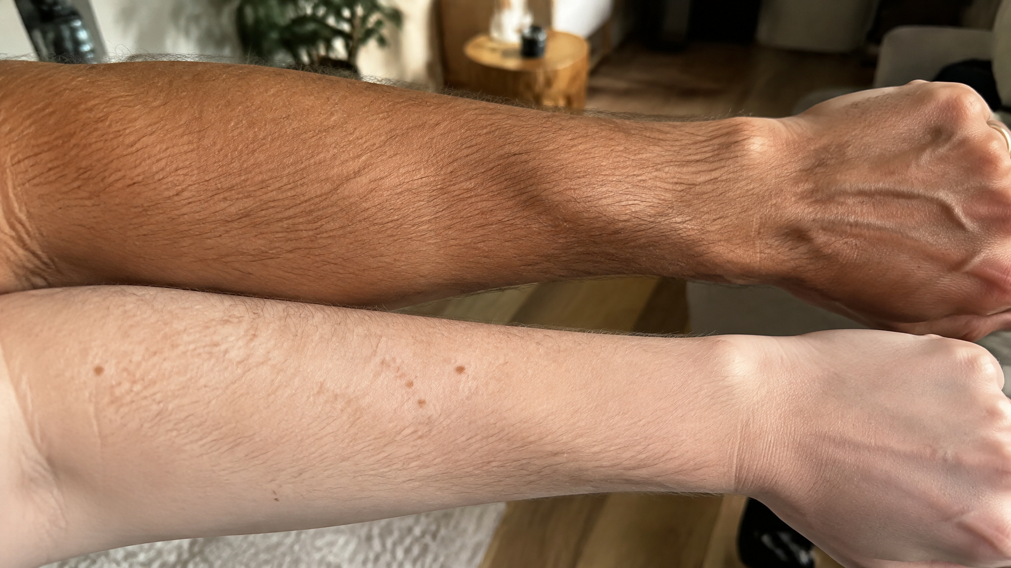 What Is MT1? The Peptide Behind Scenesse, Explained by Someone Who Used It a Decade Ago 4 Comparing tanned and untanned skin to illustrate MT1 versus MT2 tanning results